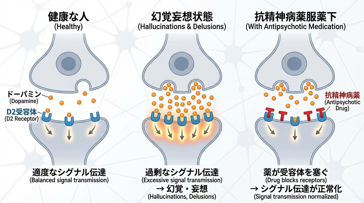 多巴胺和精神分裂症突触图 生成效果示例
